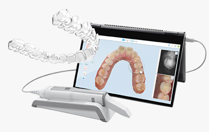 인비절라인 치아교정 - INVISALIGN 맞춤 투명교정, 인비절라인