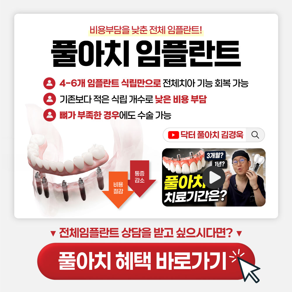 풀아치 임플란트